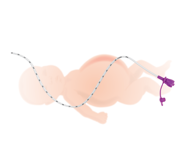Baby met high-flow sonde